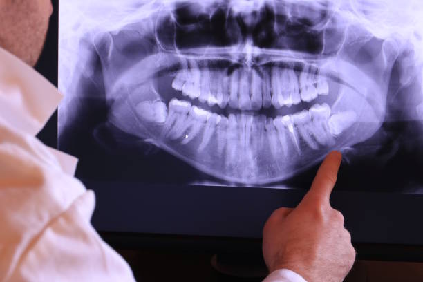 Best Emergency Dentist Near Me  in Iselin, NJ