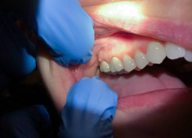 Best Knocked-Out Tooth Emergency  in Iselin, NJ