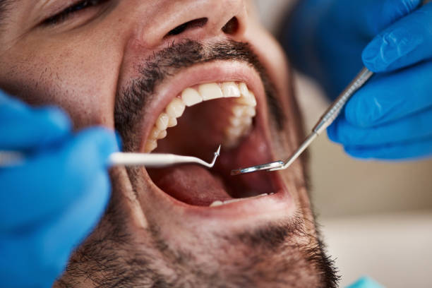 Best Broken Tooth Emergency  in Iselin, NJ